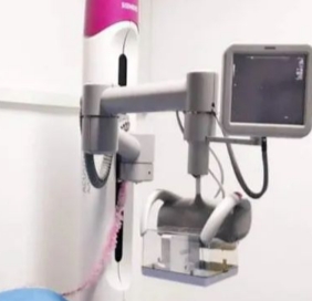 SW-BR01/II乳腺超声图像分析软件