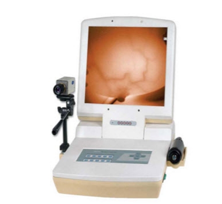 RX-1200B 红外乳腺诊断仪 