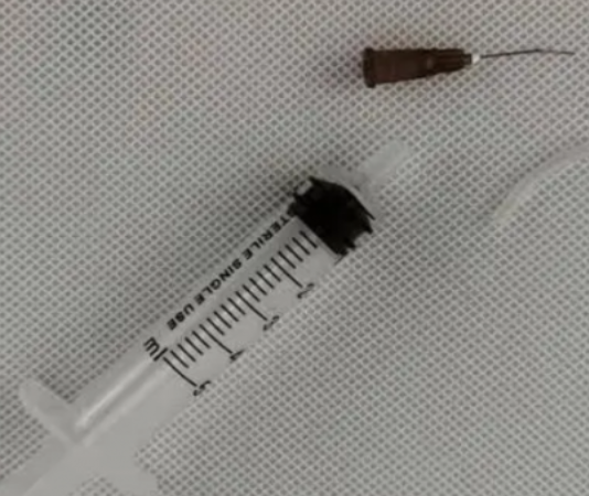 一次性无菌泪道冲洗器0.55x25