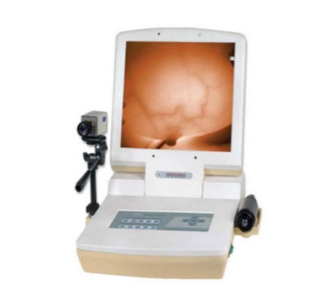 RX-1200B型 红外乳腺诊断仪 