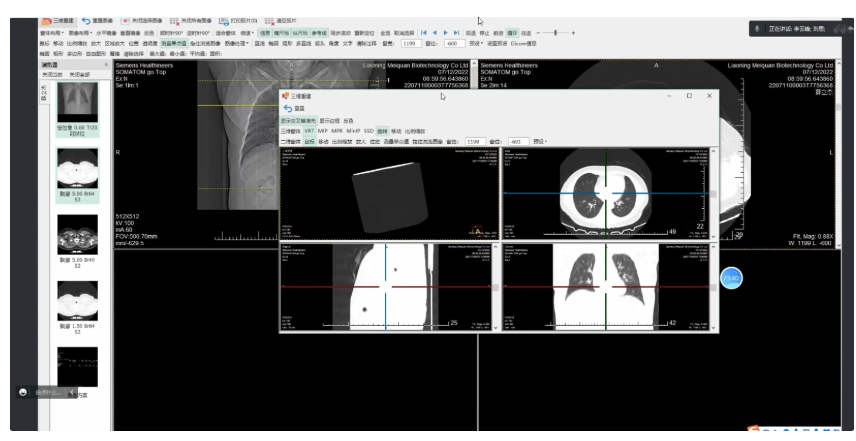 HINAMobileImageViewerV2.0 移动医学影像存储传输处理系统