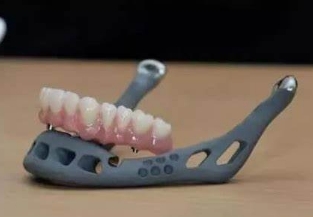 NL3D-KQ01定制式3D打印人体医学模型华翔