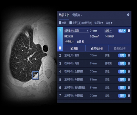 ai-rad companion 肺结节ct图像辅助检测软件