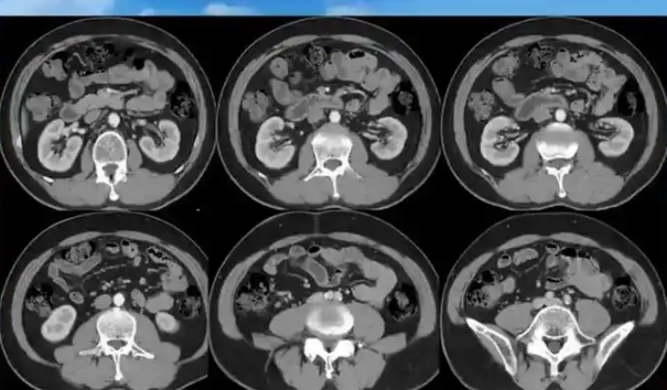 3Ddigestive 消化道CT影像处理软件