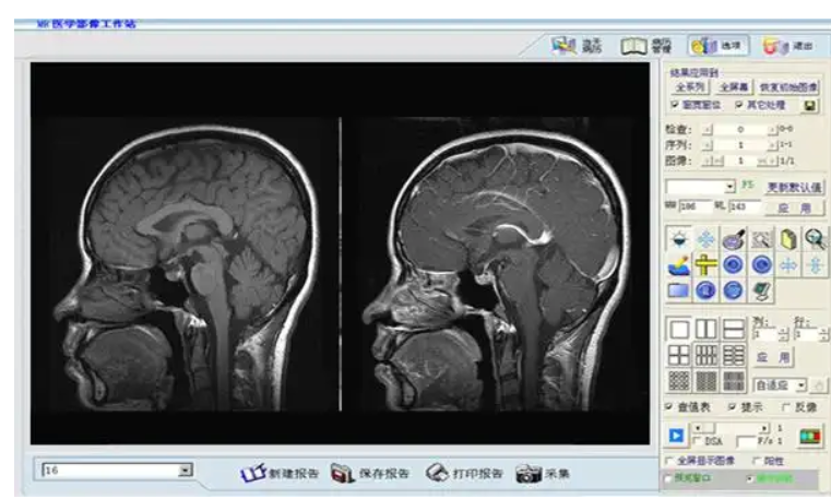 uAI-BrainImaging-MRI 头部磁共振影像处理软件