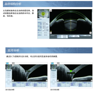 MIAS-2000(1.1) 眼科影像存储处理与分析系统