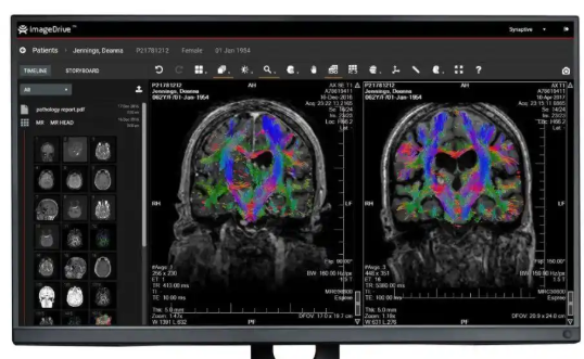 Brain 96 磁共振神经影像处理软件