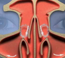 11.png