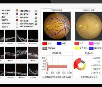 RDS 圣为眼科影像管理与通讯系统软件