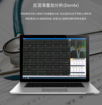 iE 90 动态心电图系统