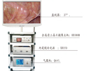L1102.1 腹腔内窥镜