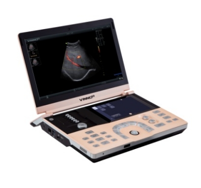 VINNO E10P 数字化彩色超声诊断仪