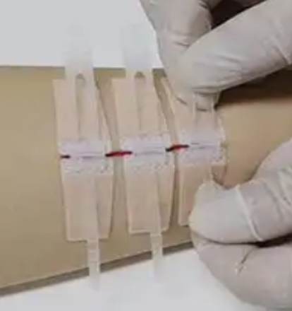 wz-Ⅰ-28 一次性使用免缝闭合器