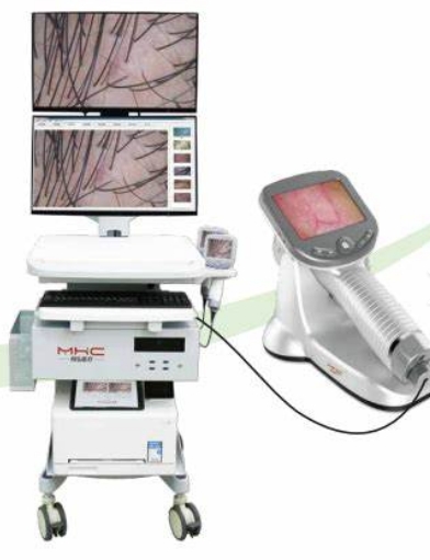 YMW-200A 医用皮肤镜影像处理工作站