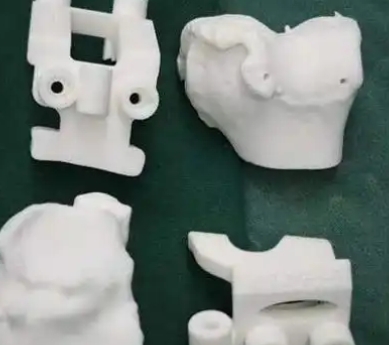 定制式3D打印截骨导板