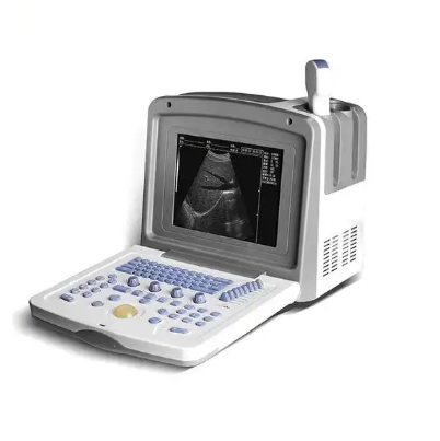U-200 全数字超声诊断仪供应商