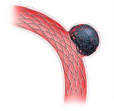血管支架Bard E·LUMINEXX Vascular Stent巴德经销商