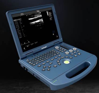 DW-L6i 笔记本式彩色多普勒超声诊断仪采购价