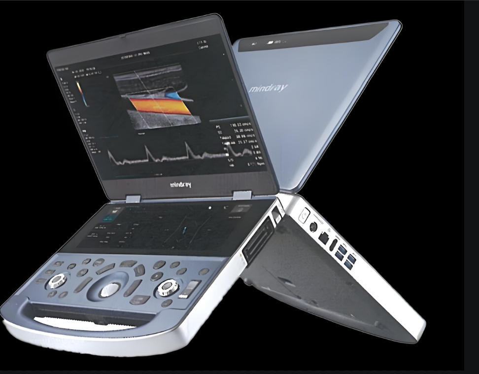 H70 掌上彩色多普勒超声系统 厂家