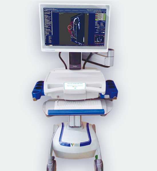 QAS-4C心脏量化分析系统厂家