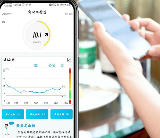 M8 持续葡萄糖监测系统价格区间